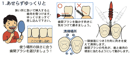 歯間ブラシ